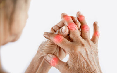 Can Diabetes Cause Arthritis?