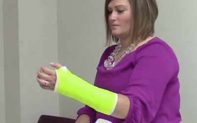 Sports Injuries Can Lead to Fractures. What are Your Cast Options?